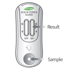 A diagnostic kit is prepared for use after it is taken from the pouch