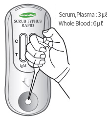 3 ㎕ of Serum or Plasma, or 6 ㎕ of Whole Blood is injected into the inlet.